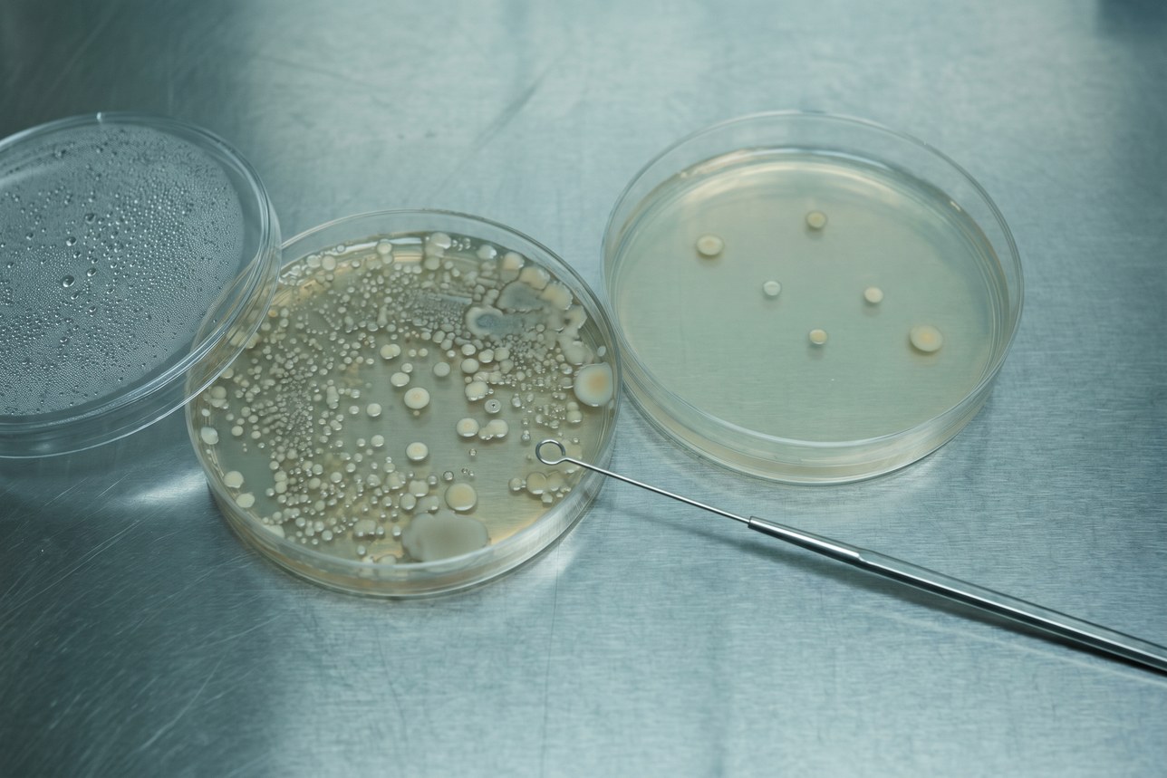 Oral probiotics for teeth and gums — a crowded plate of colonies beside an almost empty one