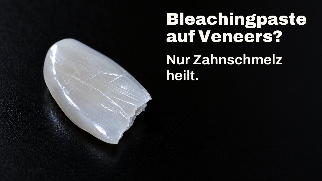 Bleaching Paste auf Veneers? Nur Zahnschmelz heilt. Im Streiflicht: eine dünne, glänzende Porzellanscherbe wie ein Veneer, von feinen Kratzern durchzogen, auf Schwarz.