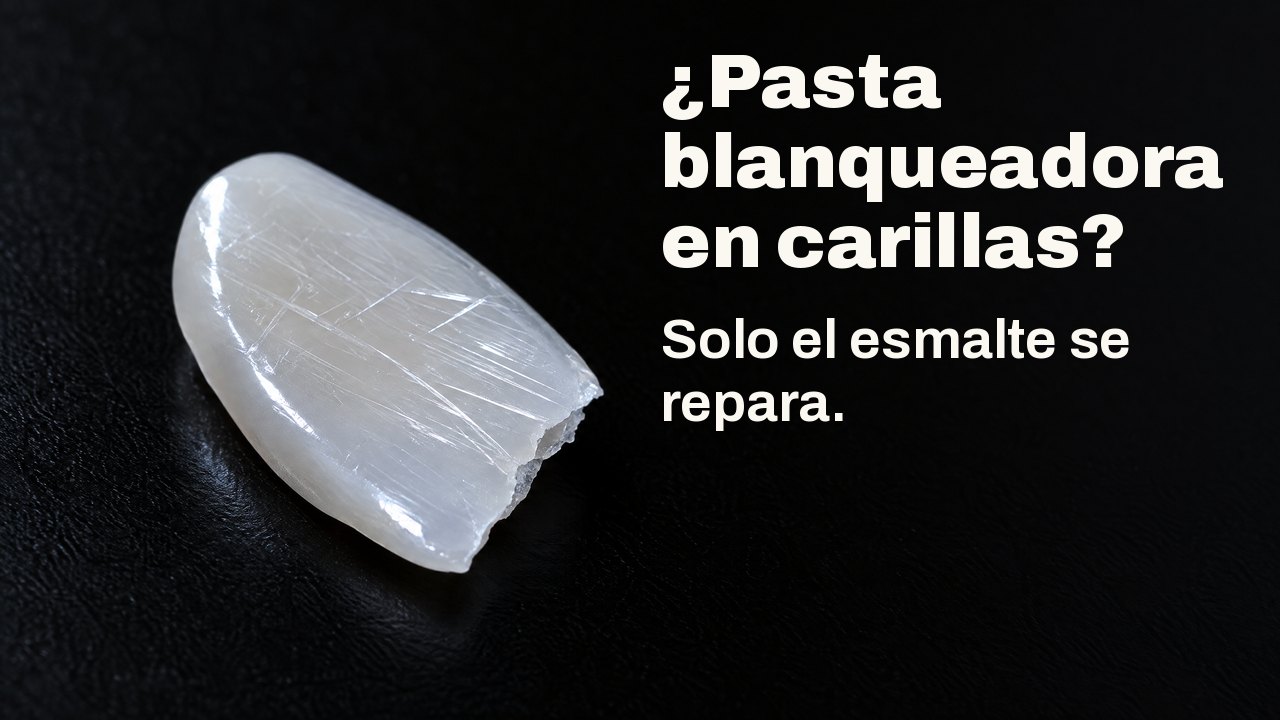 ¿Pasta blanqueadora en carillas? Solo el esmalte se repara. Con luz rasante: un fino fragmento de porcelana brillante, como una carilla, surcado de finos arañazos, sobre negro.