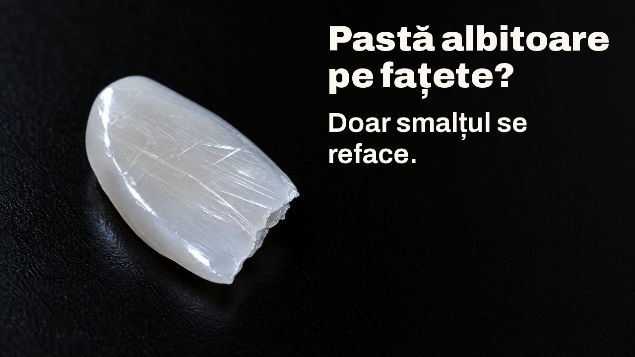 Pastă albitoare pe fațete? Doar smalțul se reface. În lumină razantă: un ciob subțire și lucios de porțelan, ca o fațetă, brăzdat de zgârieturi fine, pe negru.