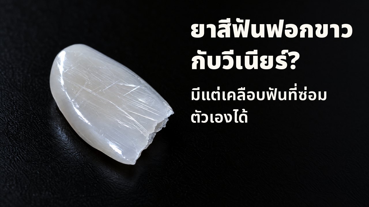 ยาสีฟันฟอกขาวกับวีเนียร์? มีแต่เคลือบฟันที่ซ่อมตัวเองได้ ใต้แสงเฉียง: เศษพอร์ซเลนบางเงาคล้ายวีเนียร์ ผิวมีรอยขีดข่วนละเอียด บนพื้นดำ