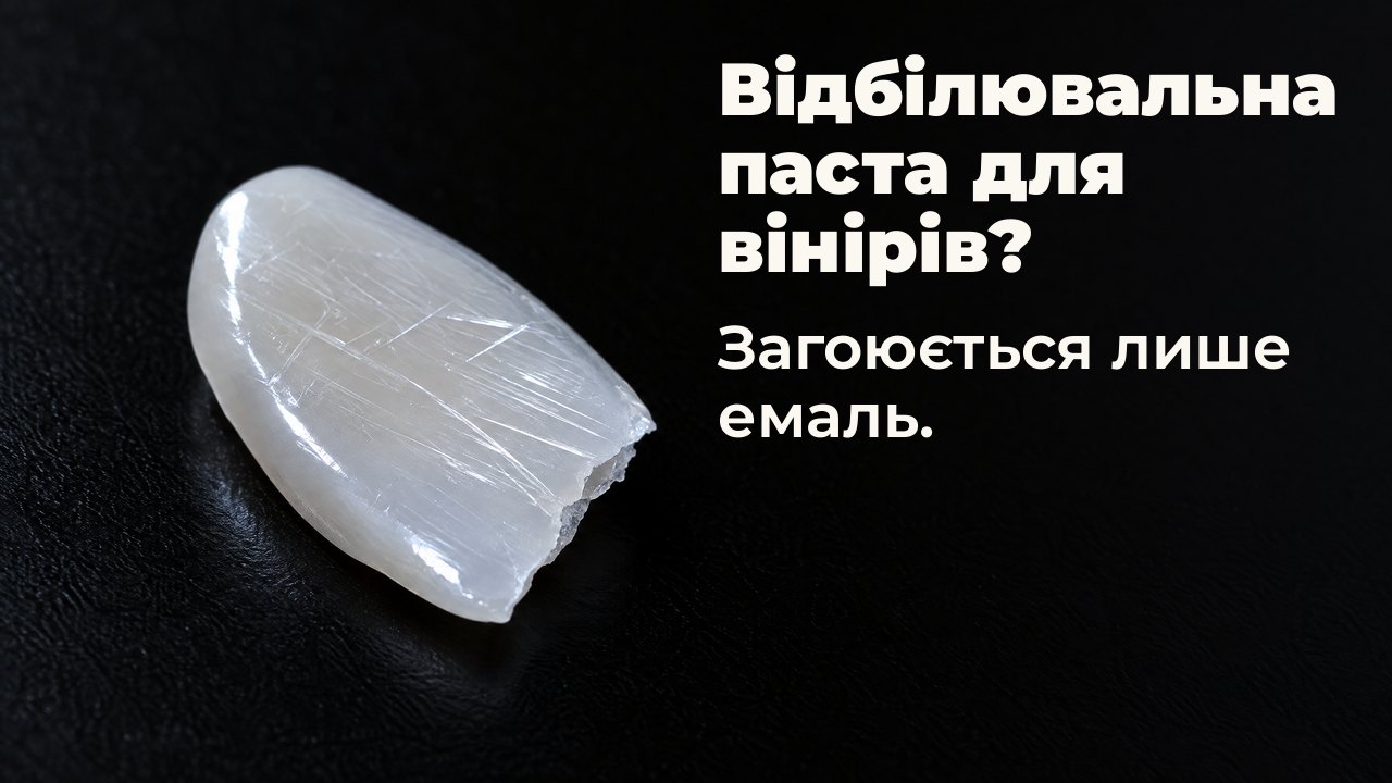 Відбілювальна паста для вінірів? Загоюється лише емаль. У косому світлі: тонкий глянцевий порцеляновий уламок, схожий на вінір, у дрібних подряпинах, на чорному.